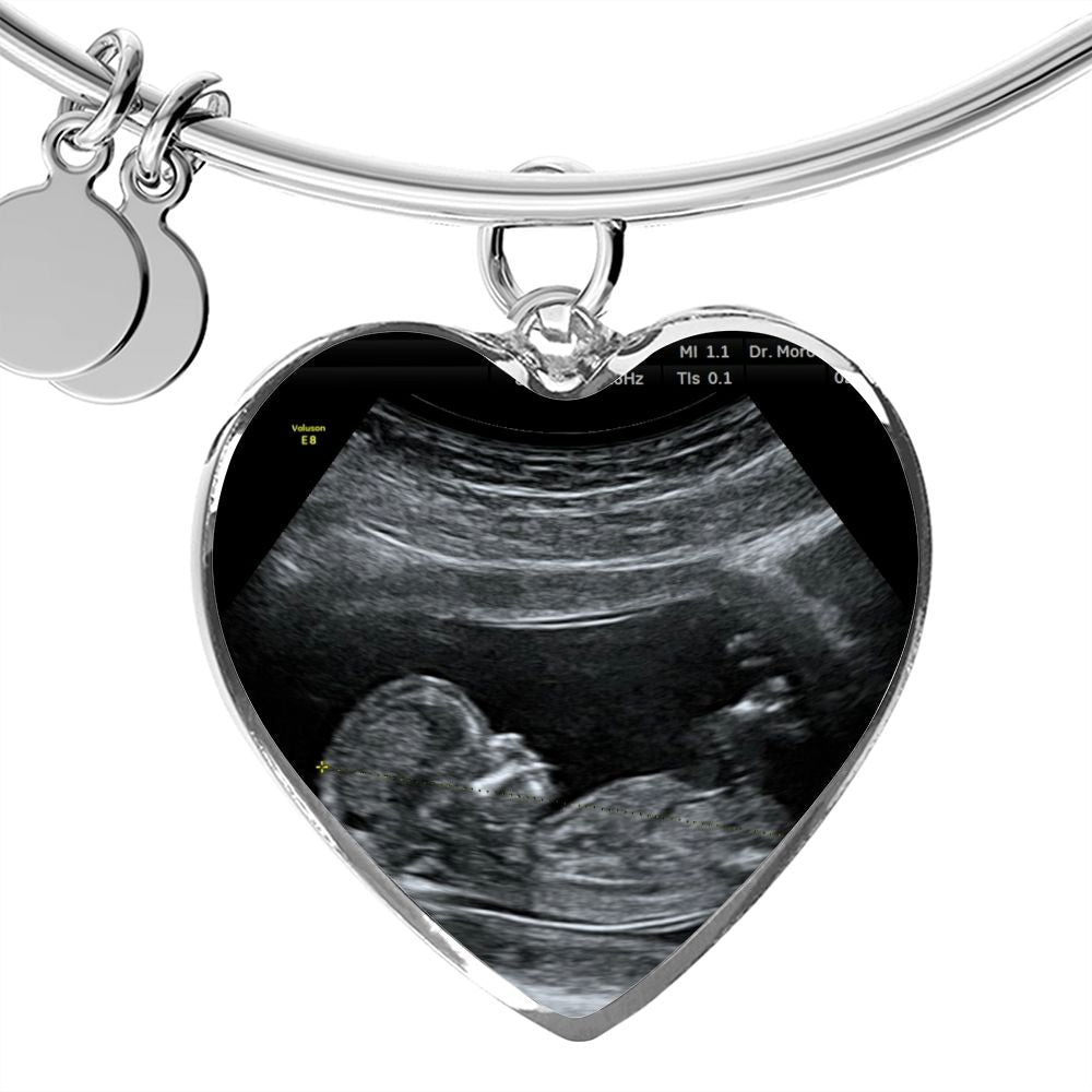 Mom Personalized Ultrasound Bracelet - Everyoou