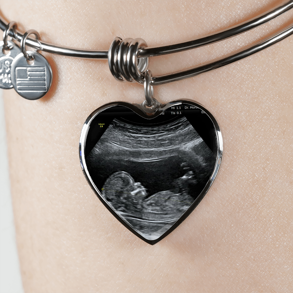 Mom Personalized Ultrasound Bracelet - Everyoou