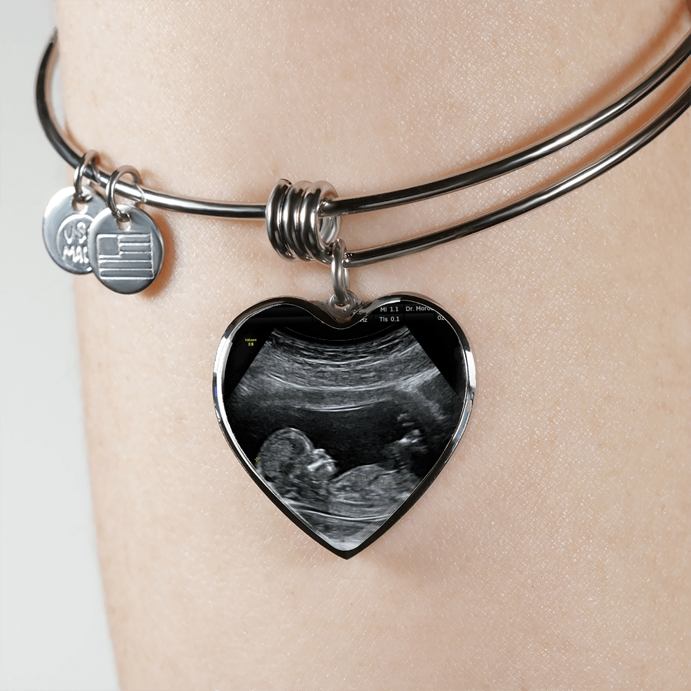 Mom Personalized Ultrasound Bracelet - Everyoou