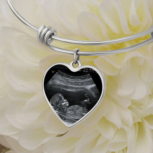 Mom Personalized Ultrasound Bracelet - Everyoou