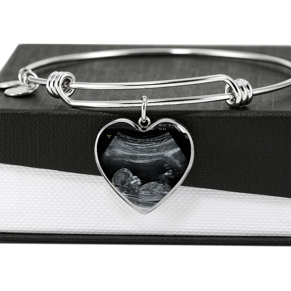 Mom Personalized Ultrasound Bracelet - Everyoou