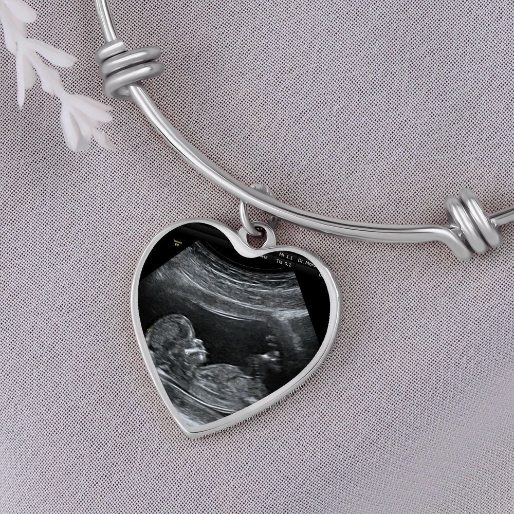 Mom Personalized Ultrasound Bracelet - Everyoou
