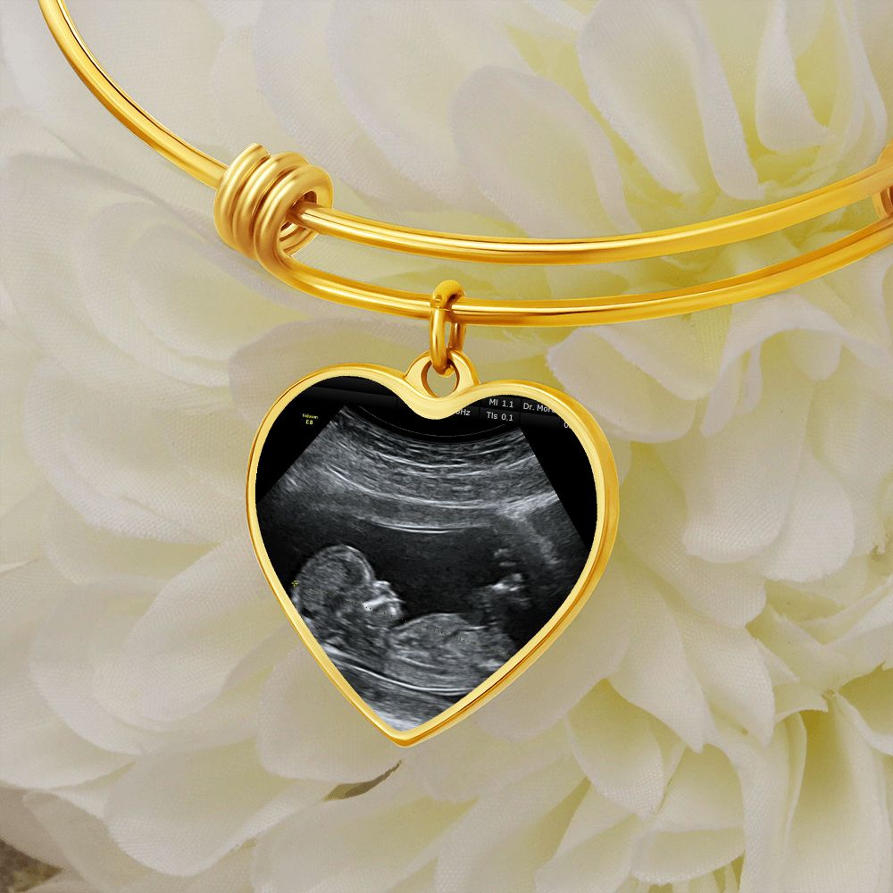 Mom Personalized Ultrasound Bracelet - Everyoou