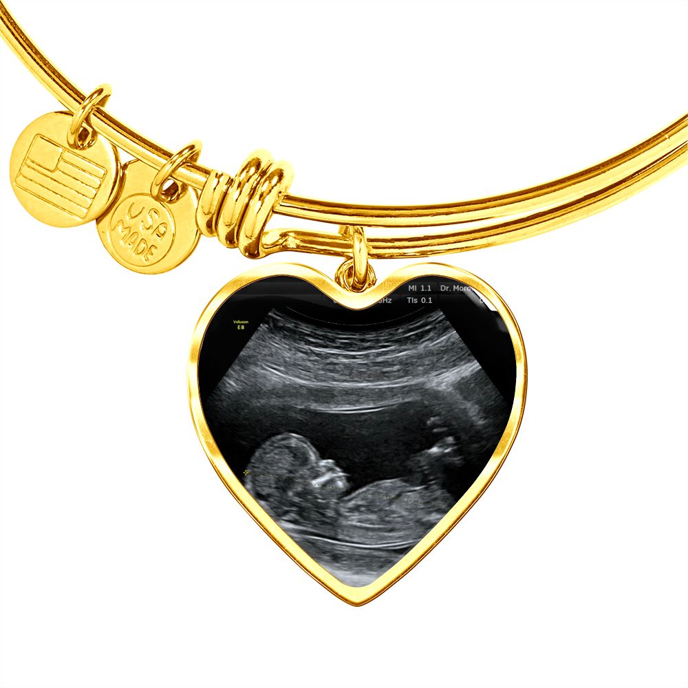 Mom Personalized Ultrasound Bracelet - Everyoou