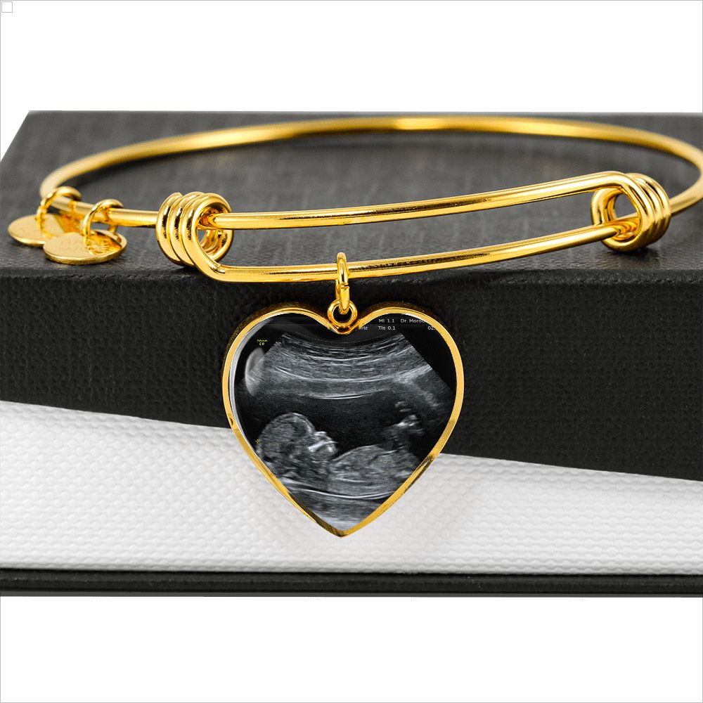 Mom Personalized Ultrasound Bracelet - Everyoou