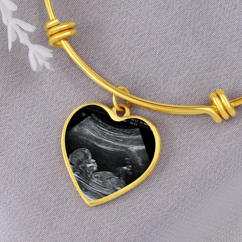 Mom Personalized Ultrasound Bracelet - Everyoou